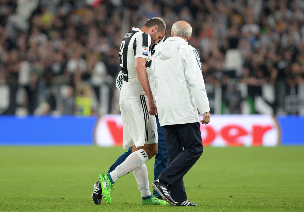 1847604-chiellini